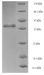 SDS-PAGE