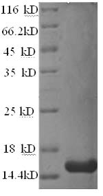 SDS-PAGE