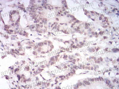 Валидация AntibodySystem RHD70003 (1736)