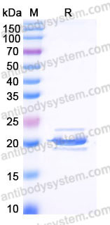 YHB91116, SDS-PAGE