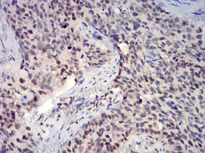 Валидация AntibodySystem RHJ11903 (3339)