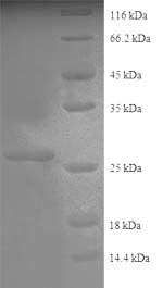 SDS-PAGE