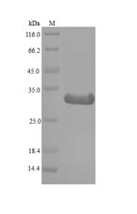 SDS-PAGE