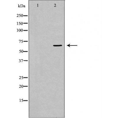 Валидация Affinity DF6589 - 18032