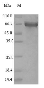 SDS-PAGE