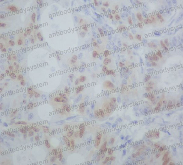 Валидация AntibodySystem RHD38202