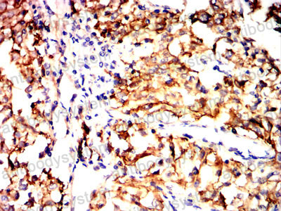 Валидация AntibodySystem RHK08803 (3618)
