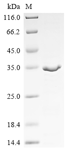 SDS-PAGE