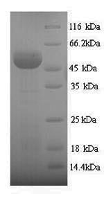 SDS-PAGE