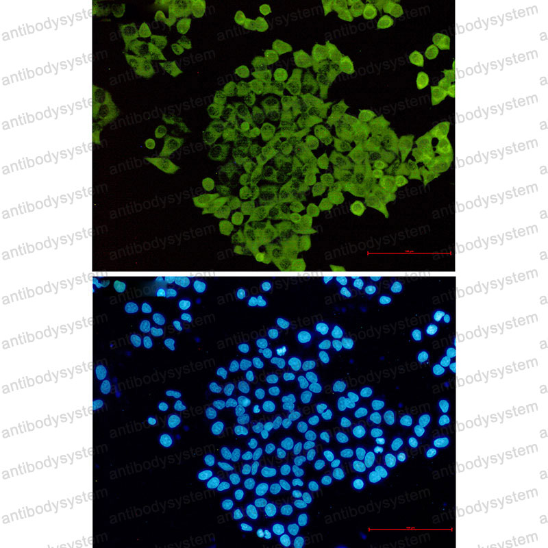 Валидация IF - AntibodySystem RHD59302