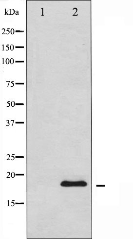 Валидация Affinity AF6285 - 3545