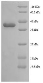 SDS-PAGE