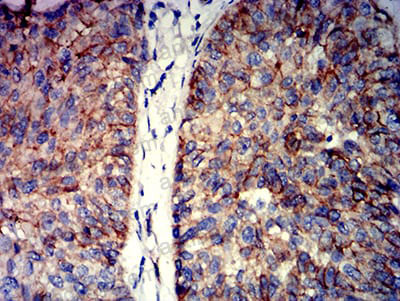 Валидация AntibodySystem RHE07608