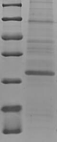 SDS-PAGE