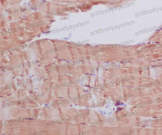 Валидация AntibodySystem RHC95601