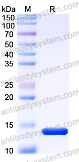EHJ31701, SDS-PAGE