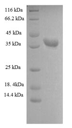 SDS-PAGE