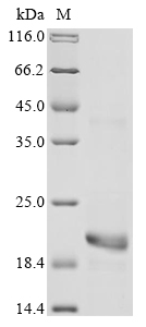 SDS-PAGE