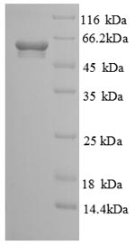 SDS-PAGE