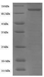 SDS-PAGE