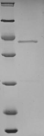 SDS-PAGE