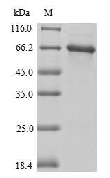 SDS-PAGE
