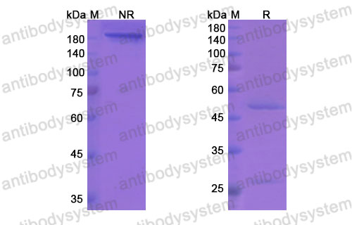 Валидация SDS-PAGE - AntibodySystem DHB34101