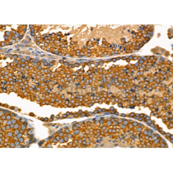 Валидация Affinity DF10204 - 5760