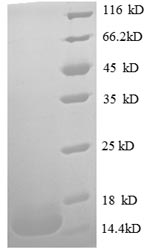 SDS-PAGE