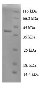 SDS-PAGE