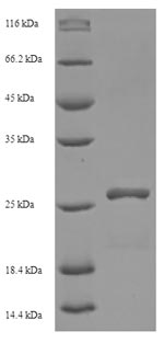 SDS-PAGE