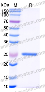 YHK71402, SDS-PAGE
