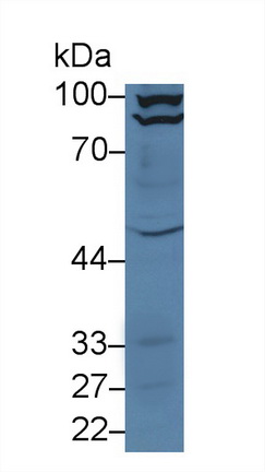 13967