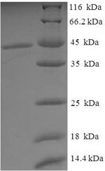 SDS-PAGE