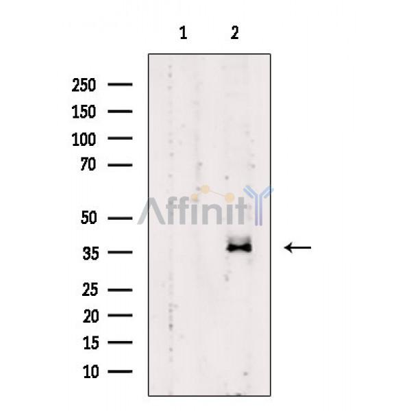Валидация Affinity DF10150 - 5675