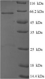 SDS-PAGE