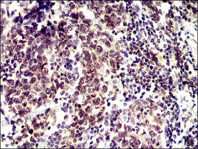 Валидация AntibodySystem RHF93301 (2736)