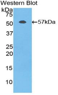 47744