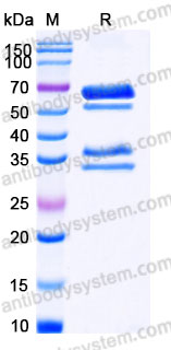 AHD03701, SDS-PAGE