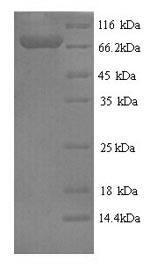 SDS-PAGE