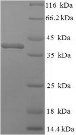 SDS-PAGE