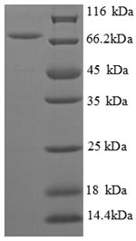 SDS-PAGE