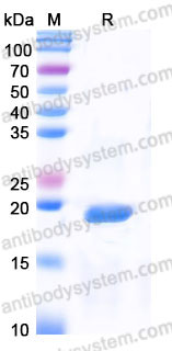 YHB33601, SDS-PAGE