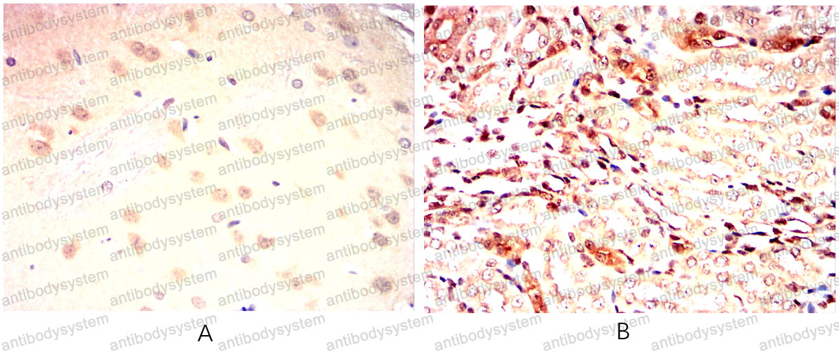 Валидация AntibodySystem RHD79503 (1826)