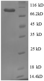 SDS-PAGE