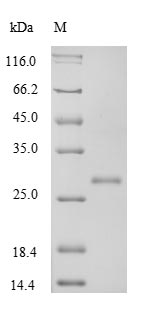 SDS-PAGE