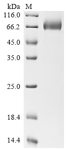 SDS-PAGE