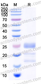 AHD47702, SDS-PAGE