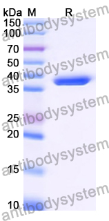YHK86201, SDS-PAGE