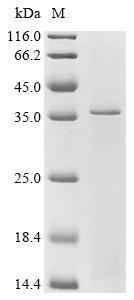 SDS-PAGE